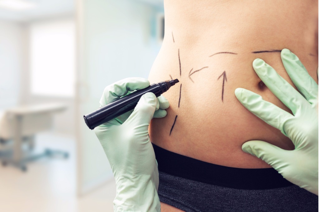 When the scalpel decides your holiday destination