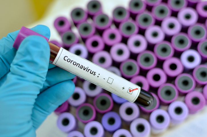 China senior medical adviser: coronavirus pandemic “over by June” if countries act